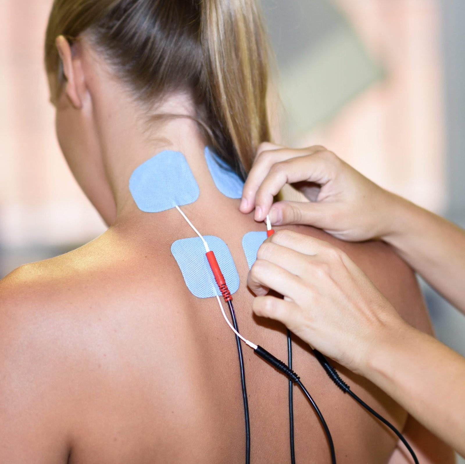 Neuromodulacion Invasiva